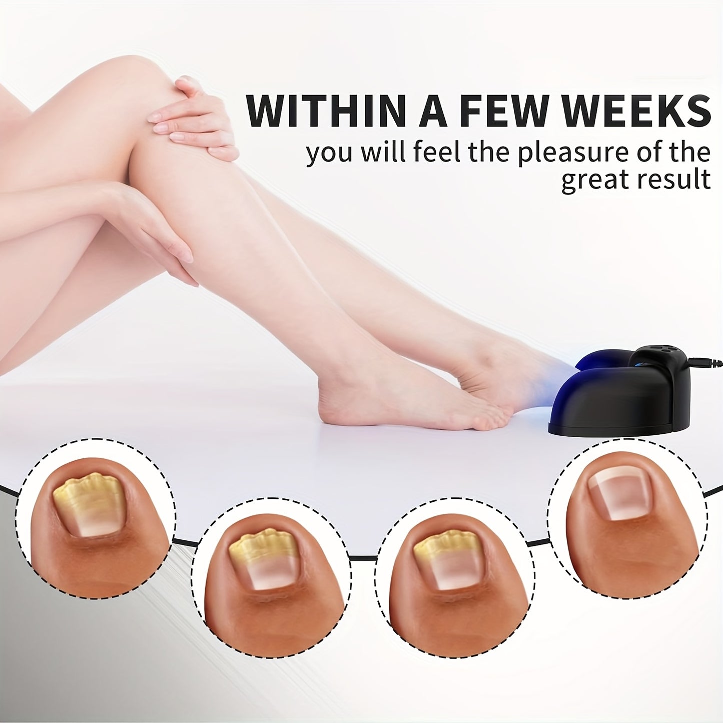 KTS Laser Device for Effective Nail Fungus Treatment and Care
