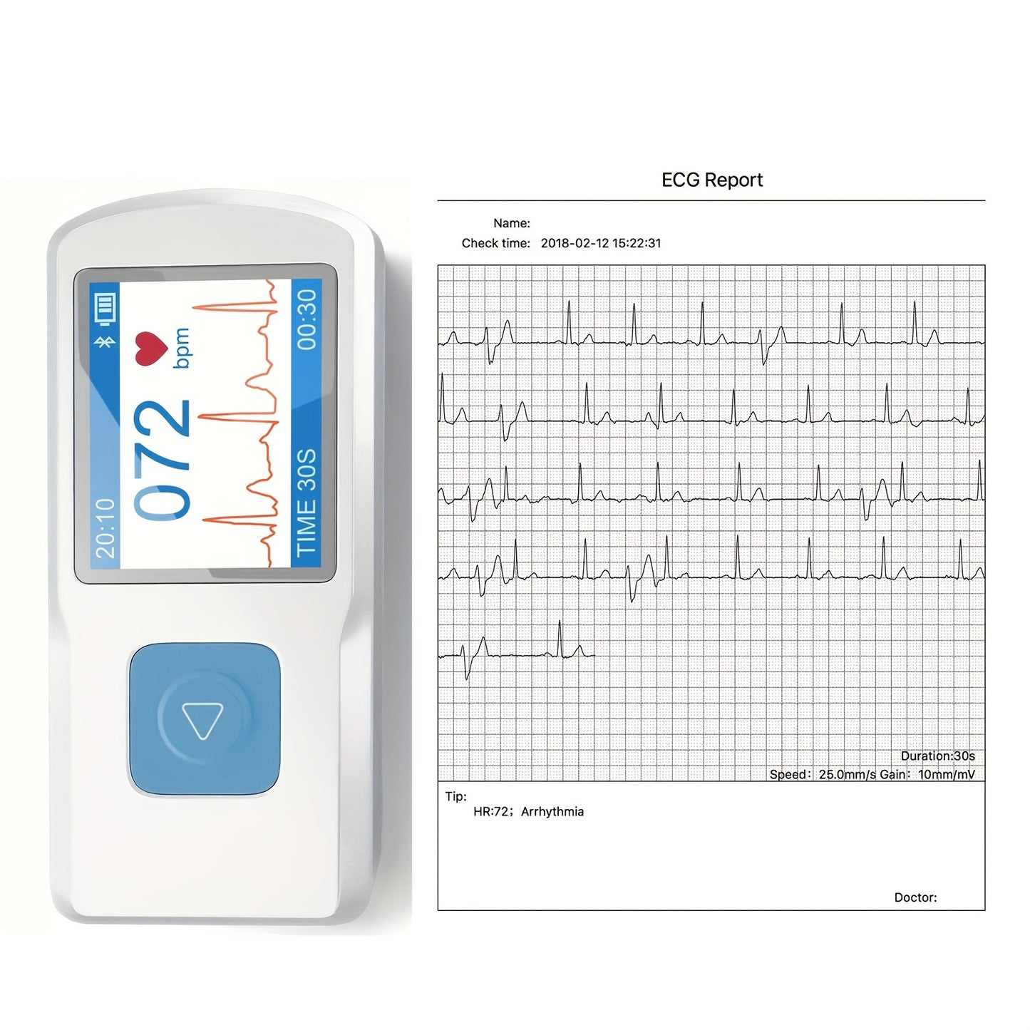 Portable ECG Monitor for Heart Rate Tracking Anytime Anywhere